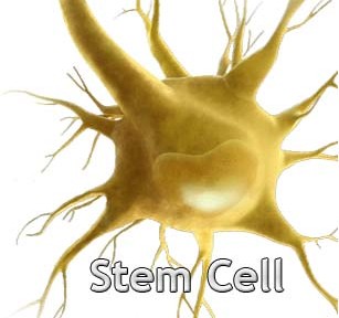 Stem cell ‘first aid’ helps recovery post stroke