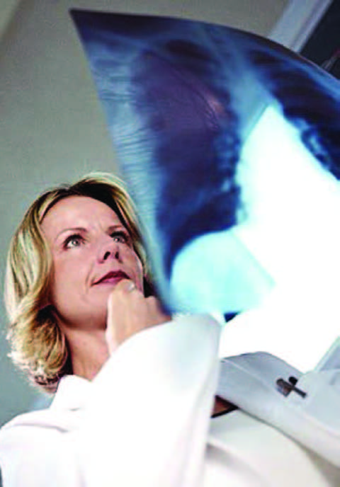LUNG CANCER KILLS MORE WOMEN THAN BREAST CANCER MAIN IMAGE