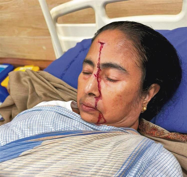 West Bengal CM Mamata Banerjee suffers ‘major injury’, admitted to hospital